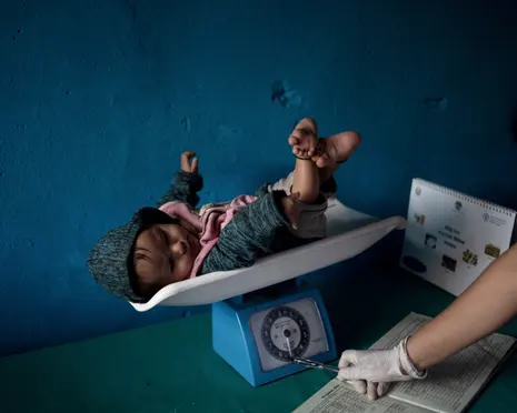 Child malnutrition in Nepal has reached ‘alarming’ levels since aid cuts, survey finds