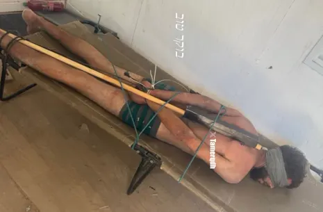 Photo of bound Palestinian detainee corroborates Israeli torture reports, say rights groups